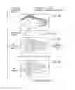 Fig. 10 - Methods of using adipose tissue-derived cells in the treatment of the lymphatic system and malignant disease