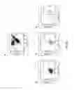 Fig. 18 - Methods of using adipose tissue-derived cells in the treatment of the lymphatic system and malignant disease