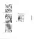 Fig. 19 - Methods of using adipose tissue-derived cells in the treatment of the lymphatic system and malignant disease