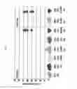 Fig. 04 - Combination therapy for a stable and long term engraftment using specific protocols for T/B cell depletion