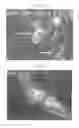Fig. 02 - Pharmaceutical coposition of cardiac stem cells and mesenchymal stem cells