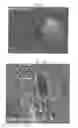 Fig. 03 - Pharmaceutical coposition of cardiac stem cells and mesenchymal stem cells