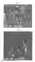 Fig. 04 - Pharmaceutical coposition of cardiac stem cells and mesenchymal stem cells