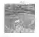 Fig. 06 - Pharmaceutical coposition of cardiac stem cells and mesenchymal stem cells