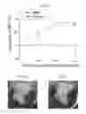 Fig. 09 - Pharmaceutical coposition of cardiac stem cells and mesenchymal stem cells