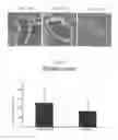 Fig. 13 - Pharmaceutical coposition of cardiac stem cells and mesenchymal stem cells