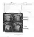 Fig. 22 - Pharmaceutical coposition of cardiac stem cells and mesenchymal stem cells