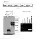 Fig. 02 - VECTOR SIMULTANEOUSLY EXPRESSING DODECAMERIC TRAIL AND HSV-TK SUICIDE GENES, AND ANTICANCER STEM CELL THERAPEUTIC AGENT USING SAME