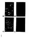 Fig. 02 - Methods of treating pain by inhibition of VGF activity