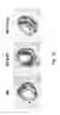 Fig. 08 - Methods for treating an established myocardial infarction