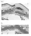 Fig. 06 - Angiogenin for treatment of glaucoma