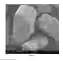Fig. 04 - PHARMACEUTICAL FORMULATION AND METHOD FOR TREATING ACID CAUSED GASTROINTESTINAL DISORDERS