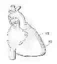 Fig. 01 - Method and system for treatment of biological tissue