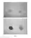 Fig. 02 - Methods of treating malnutrition