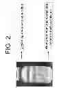 Fig. 03 - STABILIZED CONCENTRATED LIQUID HUMAN MILK FORTIFIER