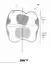 Fig. 06 - Method of manufacturing a prosthetic element