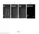 Fig. 09 - METHOD OF CO-CULTURING HUMAN ENDOMETRIAL STEM CELLS AND RAT EMBRYONIC TOOTH BUD CELLS TO OBTAIN AMELOBLAST CELLS