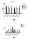 Fig. 04 - Diagnosis of tuberculosis