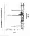 Fig. 12 - Diagnosis of tuberculosis