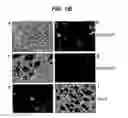 Fig. 03 - Neural stem cells