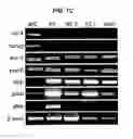 Fig. 04 - Neural stem cells