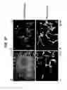 Fig. 07 - Neural stem cells