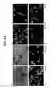 Fig. 14 - Neural stem cells