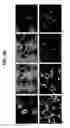 Fig. 15 - Neural stem cells