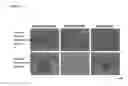 Fig. 07 - Mesenchymal stem cell basic culturing medium