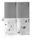 Fig. 02 - MULTIMER TYPE DISCRIMINATION AND DETECTION METHOD FOR MULTIMER-FORMING POLYPEPTIDE