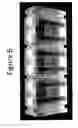 Fig. 07 - Unitary biochip providing sample-in to results-out processing and methods of manufacture