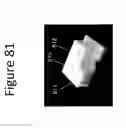 Fig. 83 - Unitary biochip providing sample-in to results-out processing and methods of manufacture