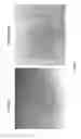 Fig. 02 - NUCLEIC ACIDS ENCODING PEPTIDES FOR TREATING WOUNDS, ANTI-ANGIOGENIC COMPOUNDS AND USES THEREOF