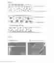 Fig. 04 - Bioabsorbable blend for temporary scaffolding of the blood vessel wall