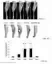 Fig. 02 - Anti-glucosaminidase passive immunization for infections