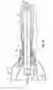 Fig. 06 - Conduit device and system for implanting a conduit device in a tissue wall