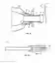 Fig. 08 - Conduit device and system for implanting a conduit device in a tissue wall