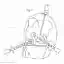 Fig. 02 - Atraumatic arthroscopic instrument sheath and method