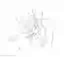 Fig. 08 - Fornix manipulator