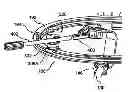 Fig. 01 - System and method for retracting body tissue