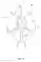 Fig. 03 - Measurement of Cerebral Physiologic Parameters Using Bioimpedance