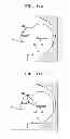 Fig. 09 - METHOD FOR AUTOMATICALLY DETECTING MID-SAGITTAL PLANE BY USING ULTRASOUND IMAGE AND APPARATUS THEREOF