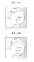 Fig. 10 - METHOD FOR AUTOMATICALLY DETECTING MID-SAGITTAL PLANE BY USING ULTRASOUND IMAGE AND APPARATUS THEREOF