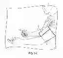 Fig. 07 - DEVICES AND METHODS FOR MEASURING BLOOD PRESSURE