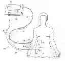 Fig. 01 - SYSTEMS AND METHODS FOR INTRA-OPERATIVE REGIONAL NEURAL STIMULATION