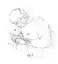 Fig. 07 - SYSTEMS AND METHODS FOR INTRA-OPERATIVE REGIONAL NEURAL STIMULATION