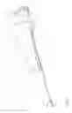 Fig. 02 - Cutter drive assembly for biopsy device