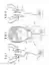 Fig. 02 - Oral mouthpiece and method for the use thereof