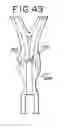 Fig. 22 - Oral mouthpiece and method for the use thereof