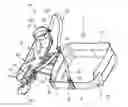 Fig. 01 - ORTHOSIS AND METHOD FOR THE PLACEMENT OF AN ORTHOSIS